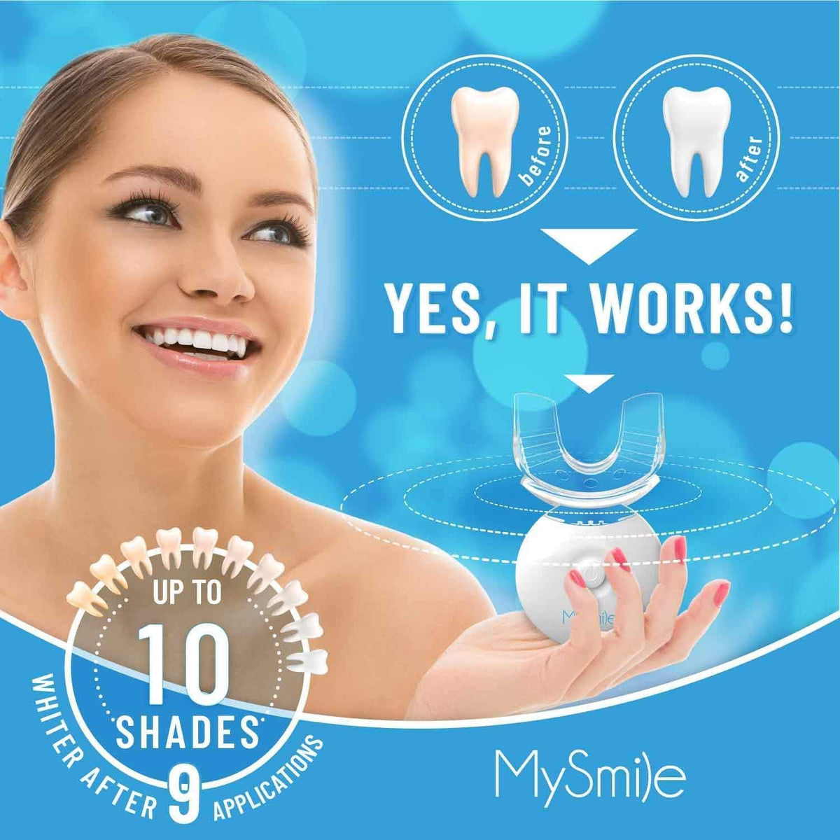 Kit de blanqueamiento MySmile
